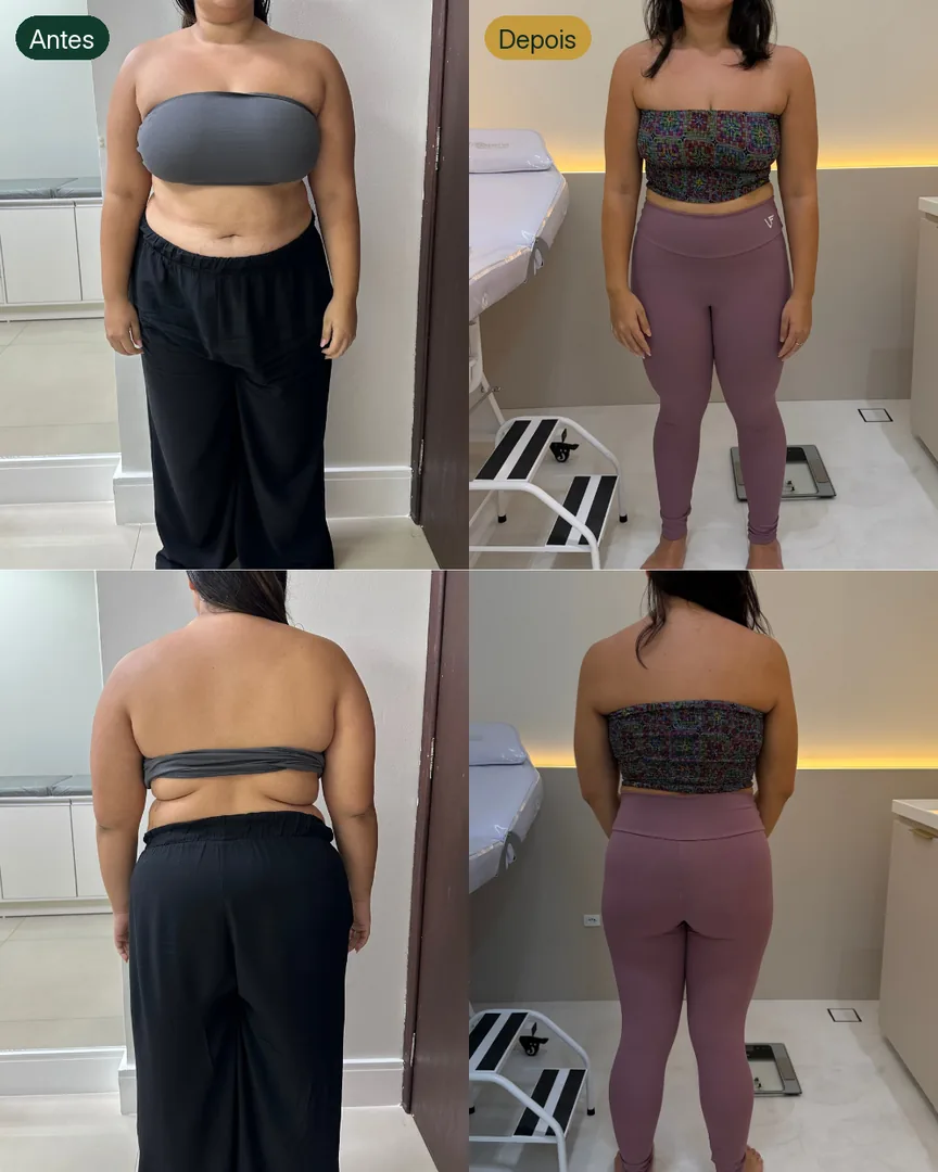 Antes e depois de paciente