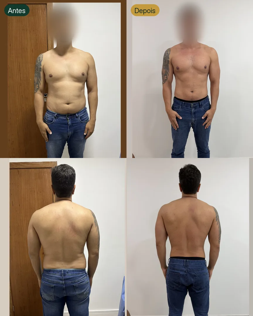Antes e depois de paciente