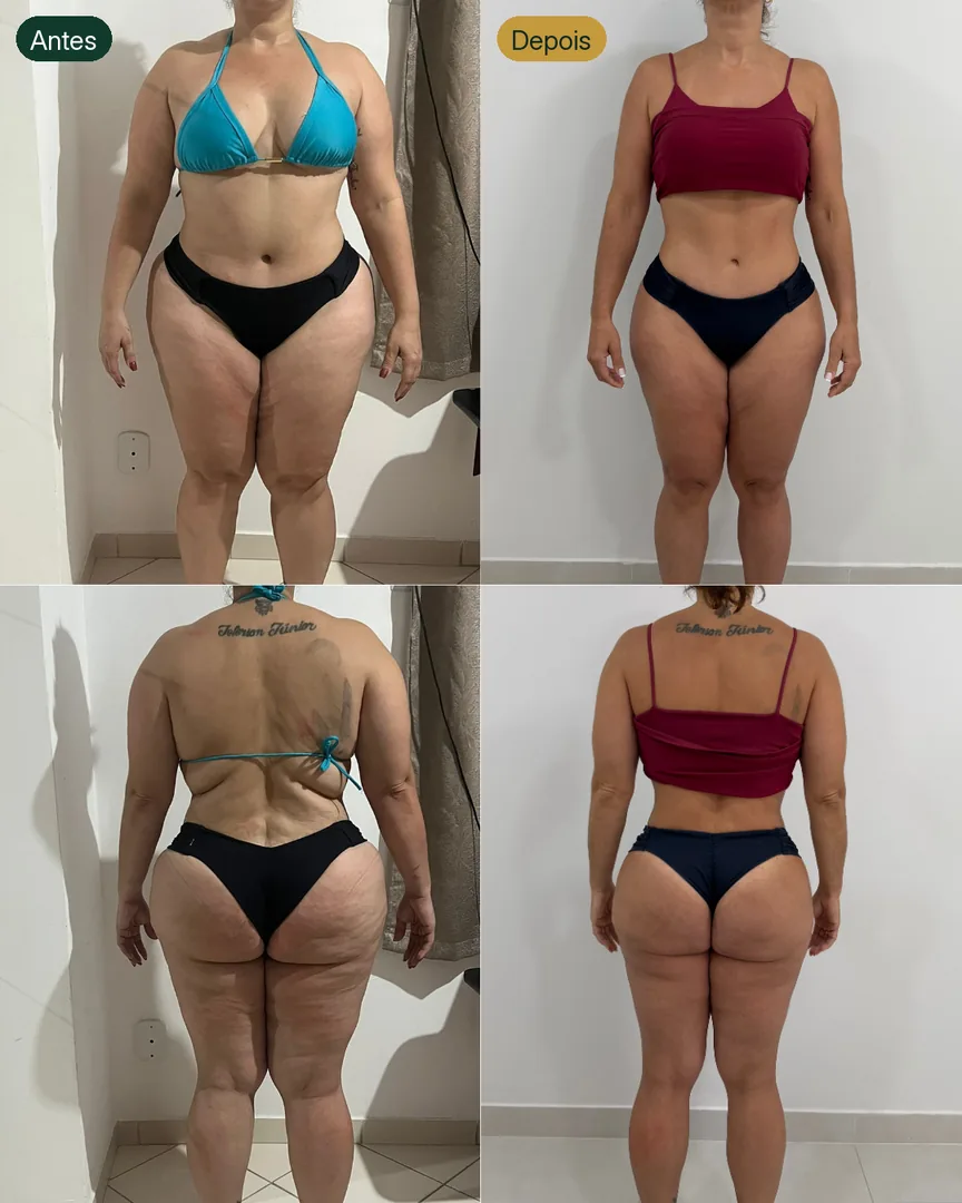 Antes e depois de paciente