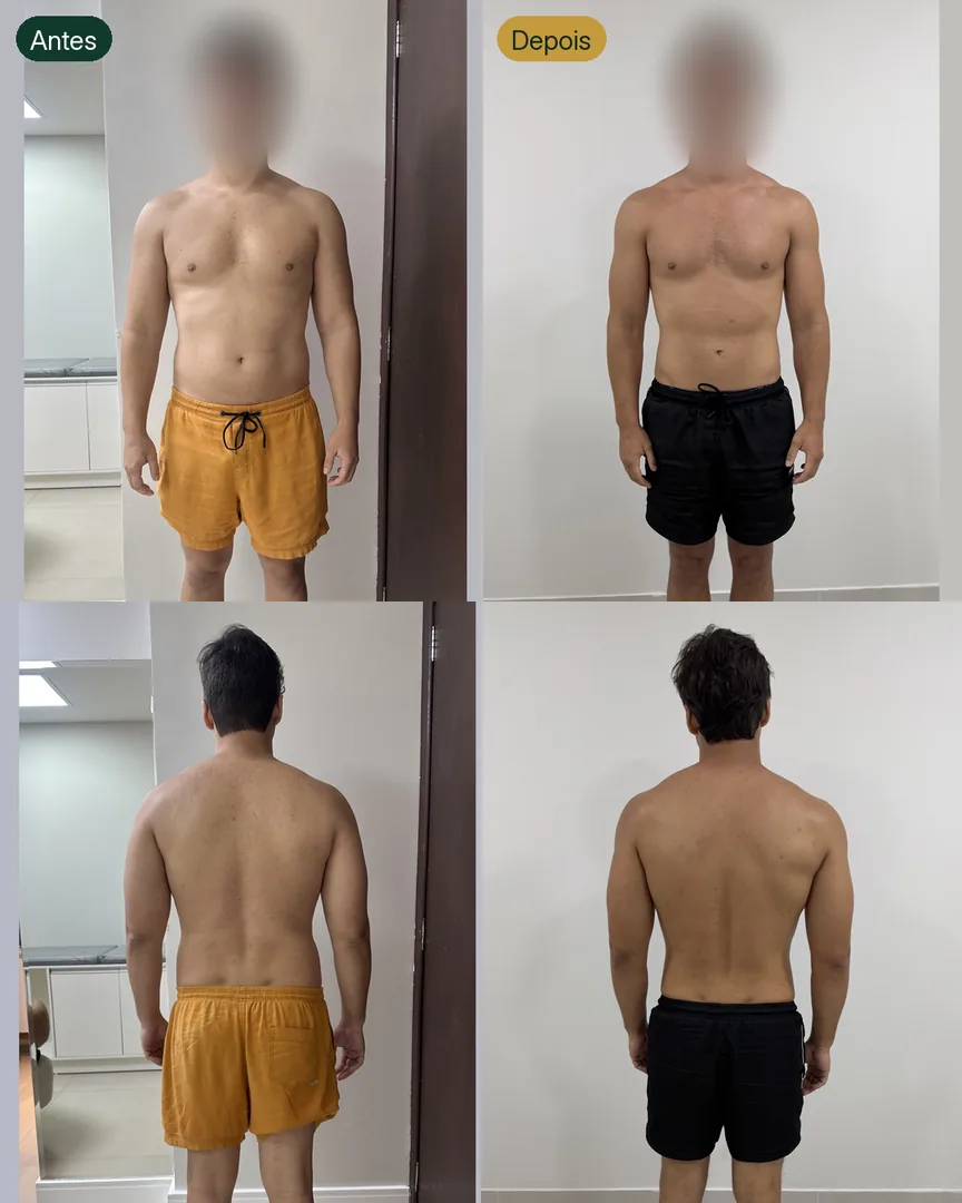 Antes e depois de paciente