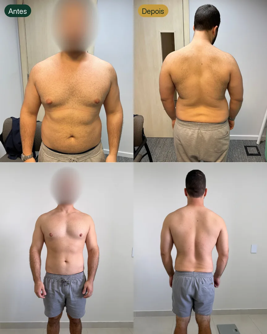 Antes e depois de paciente