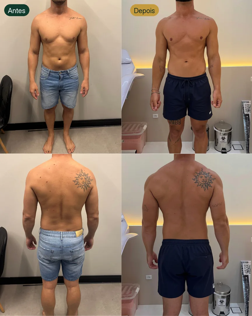 Antes e depois de paciente