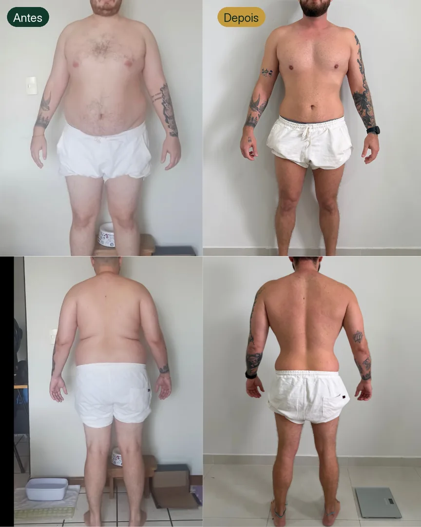 Antes e depois de paciente