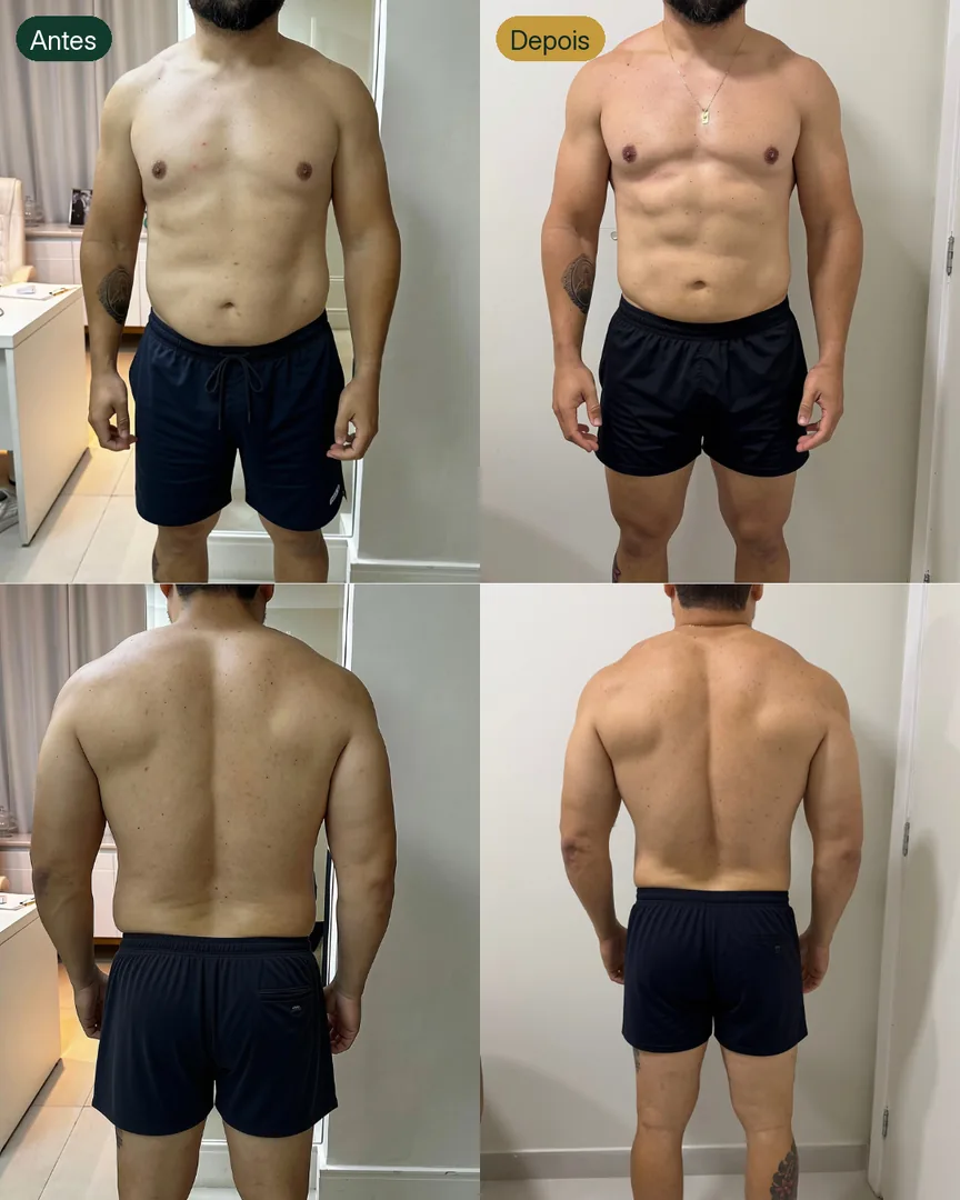 Antes e depois de paciente