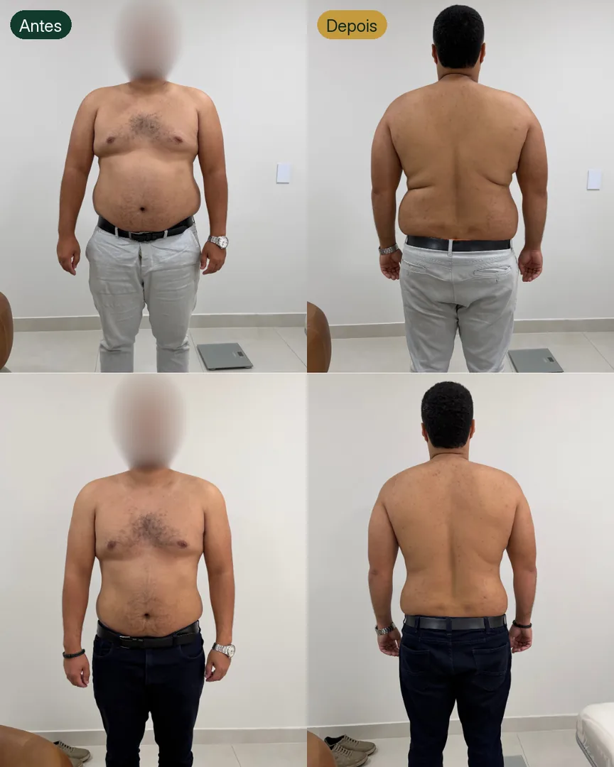 Antes e depois de paciente