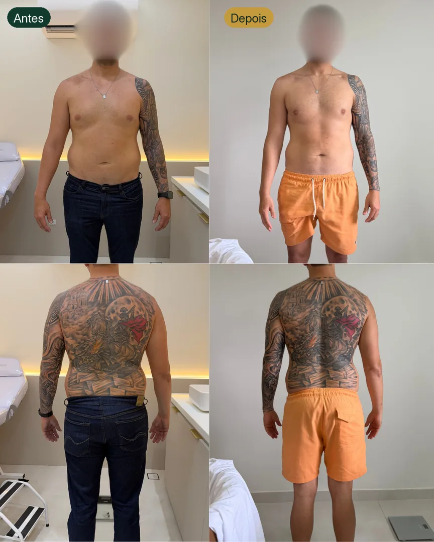 Antes e depois de paciente