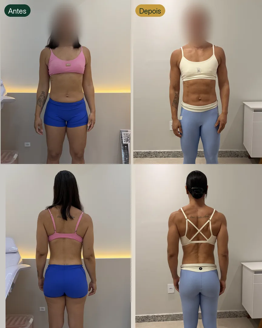 Antes e depois de paciente