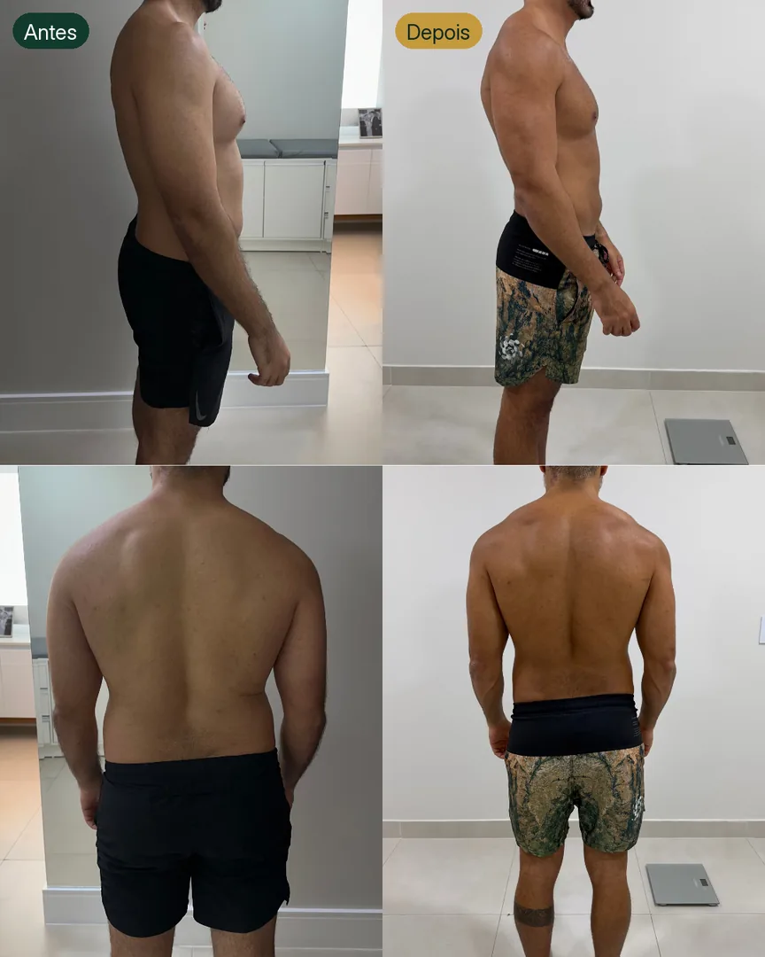 Antes e depois de paciente