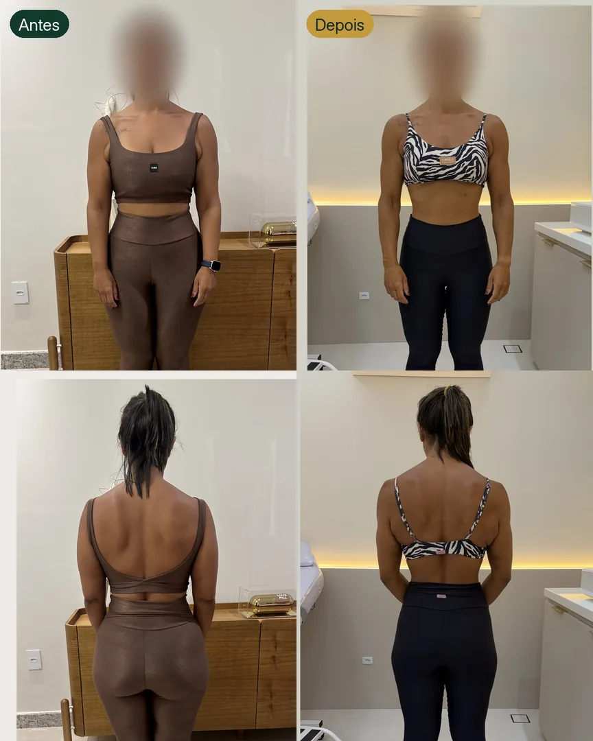 Antes e depois de paciente