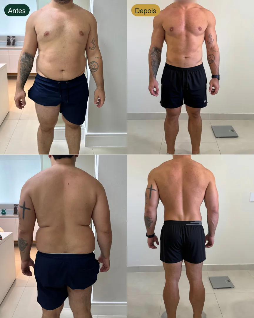 Antes e depois de paciente