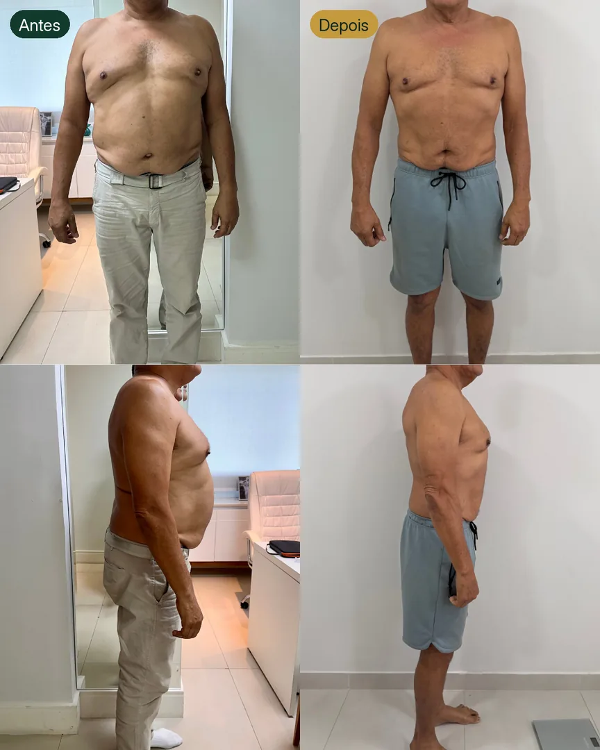 Antes e depois de paciente