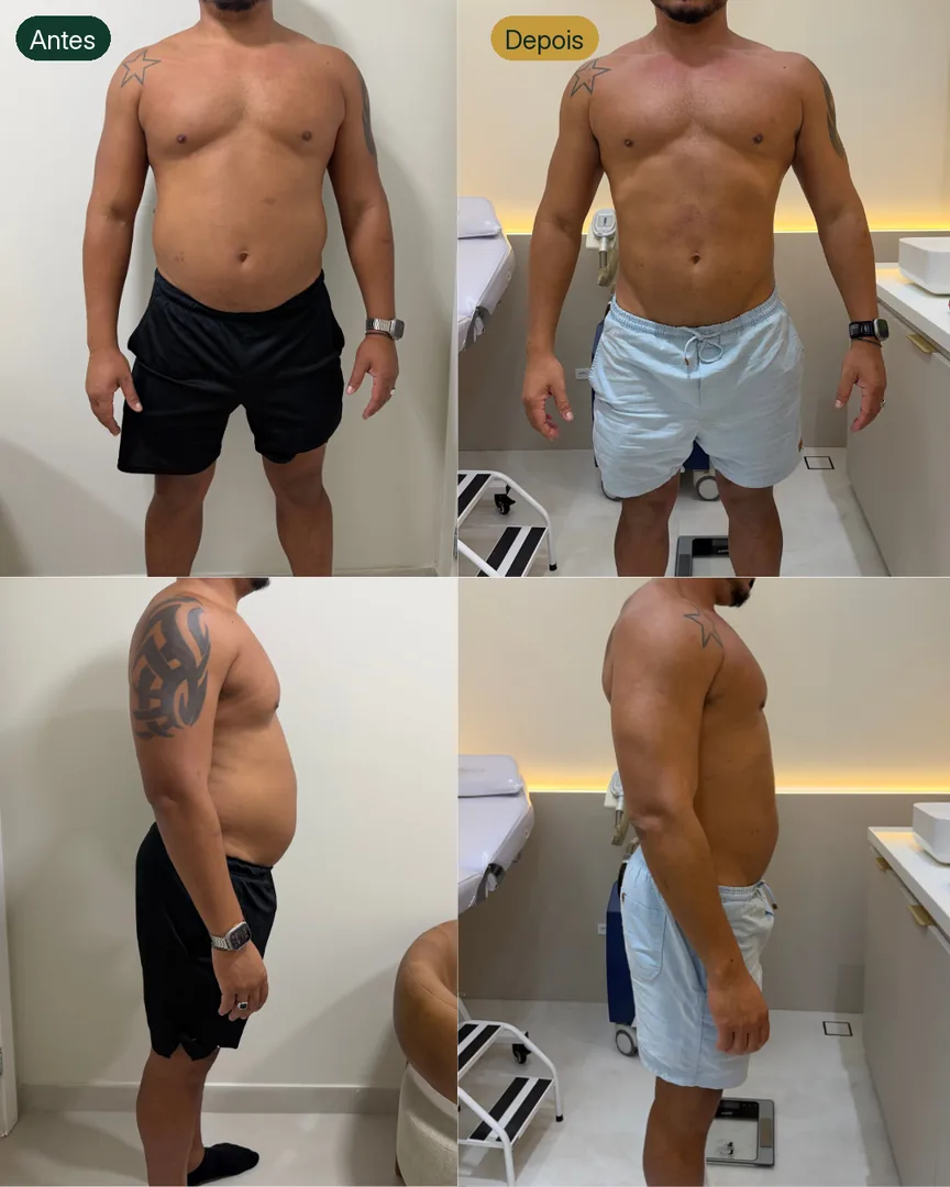 Antes e depois de paciente