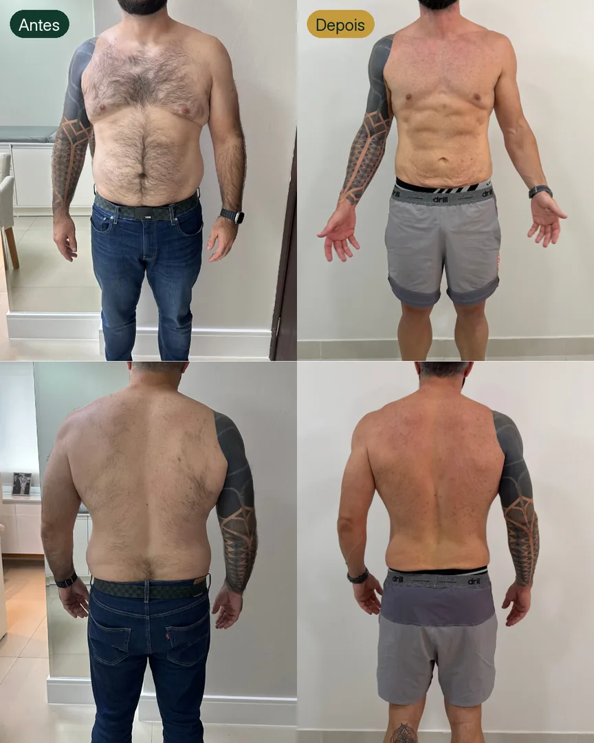 Antes e depois de paciente