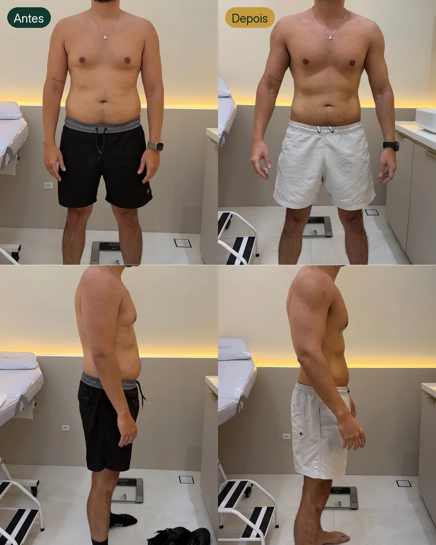Antes e depois de paciente