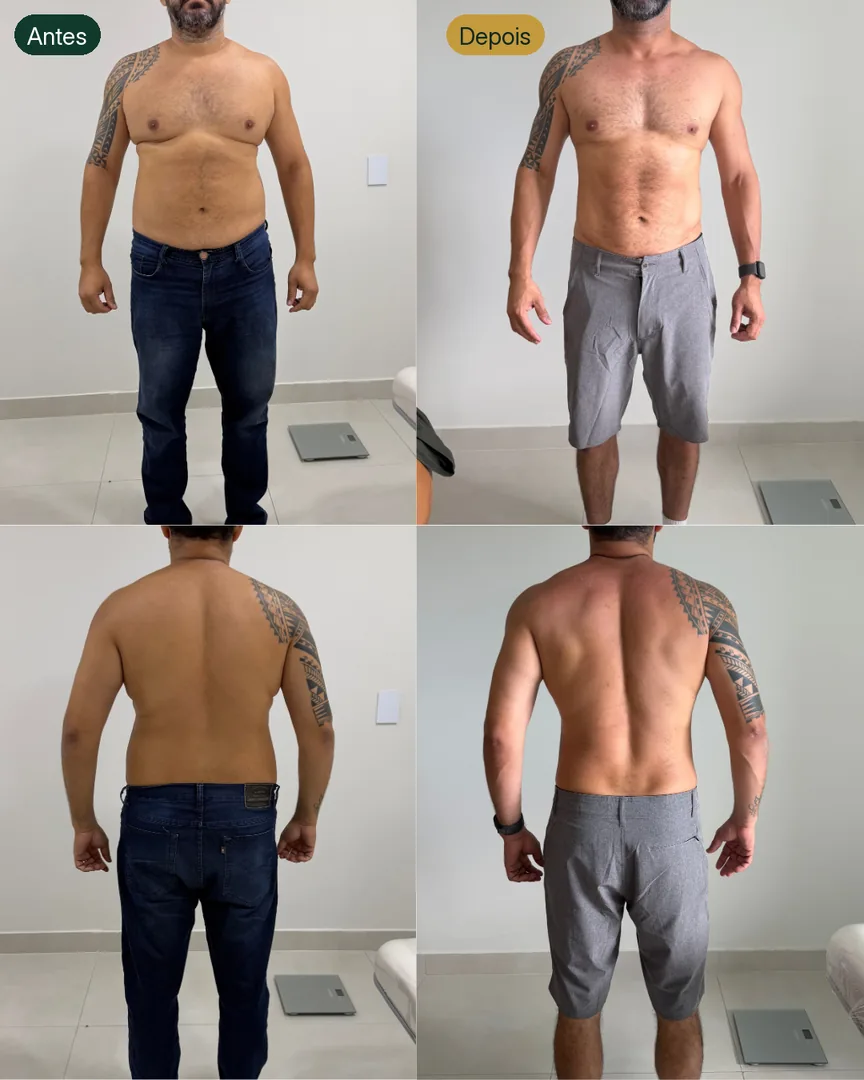 Antes e depois de paciente
