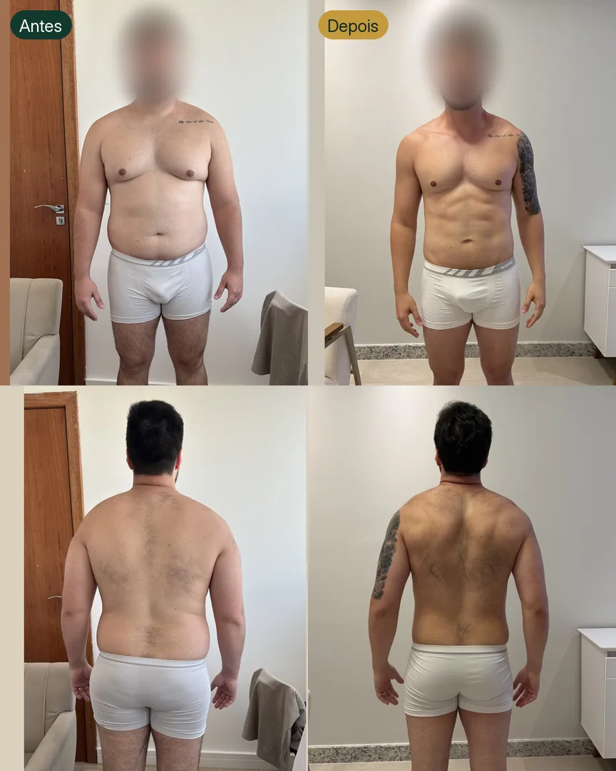 Antes e depois de paciente