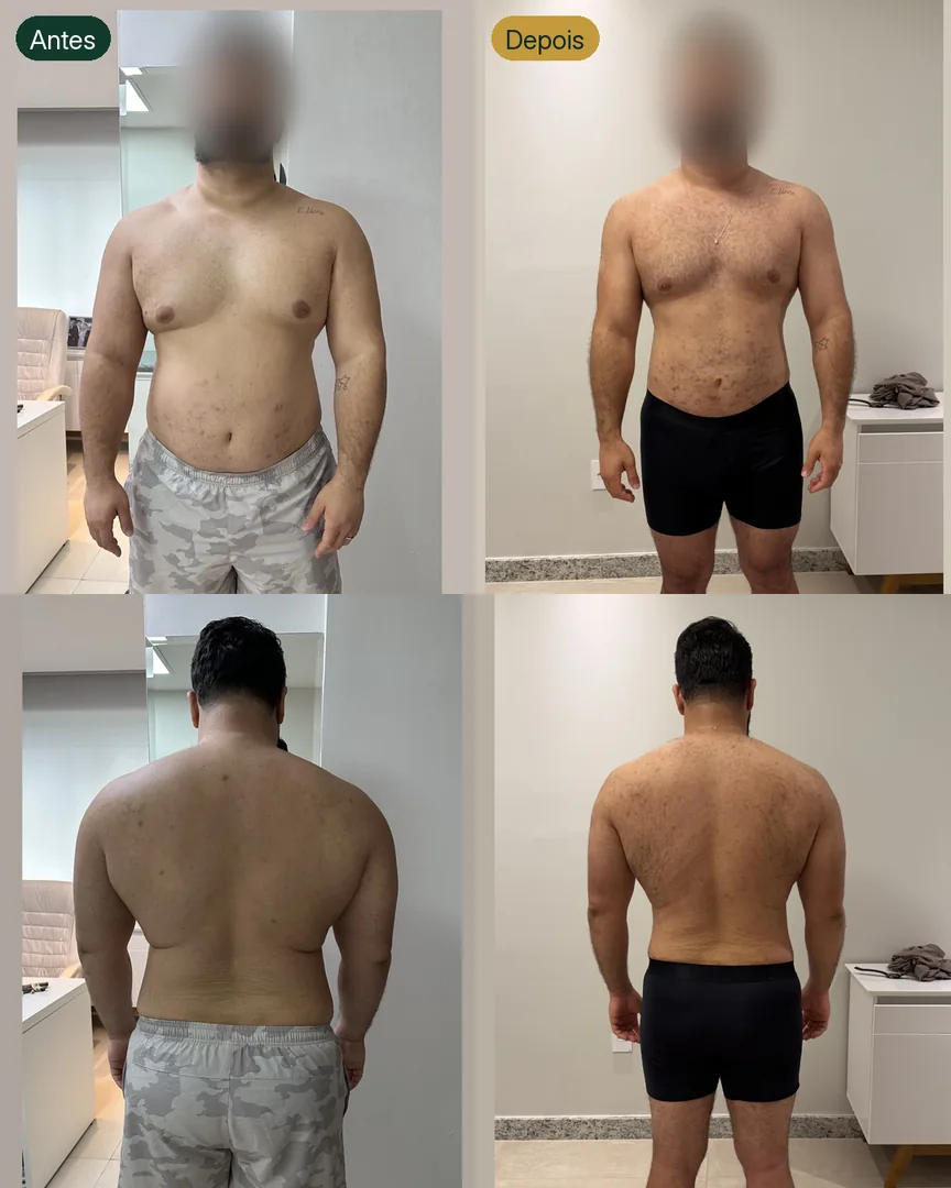 Antes e depois de paciente