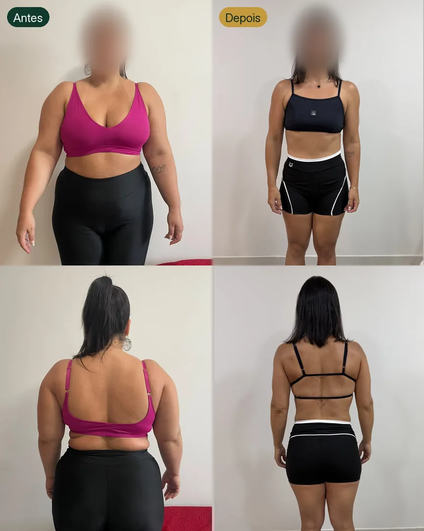 Antes e depois de paciente
