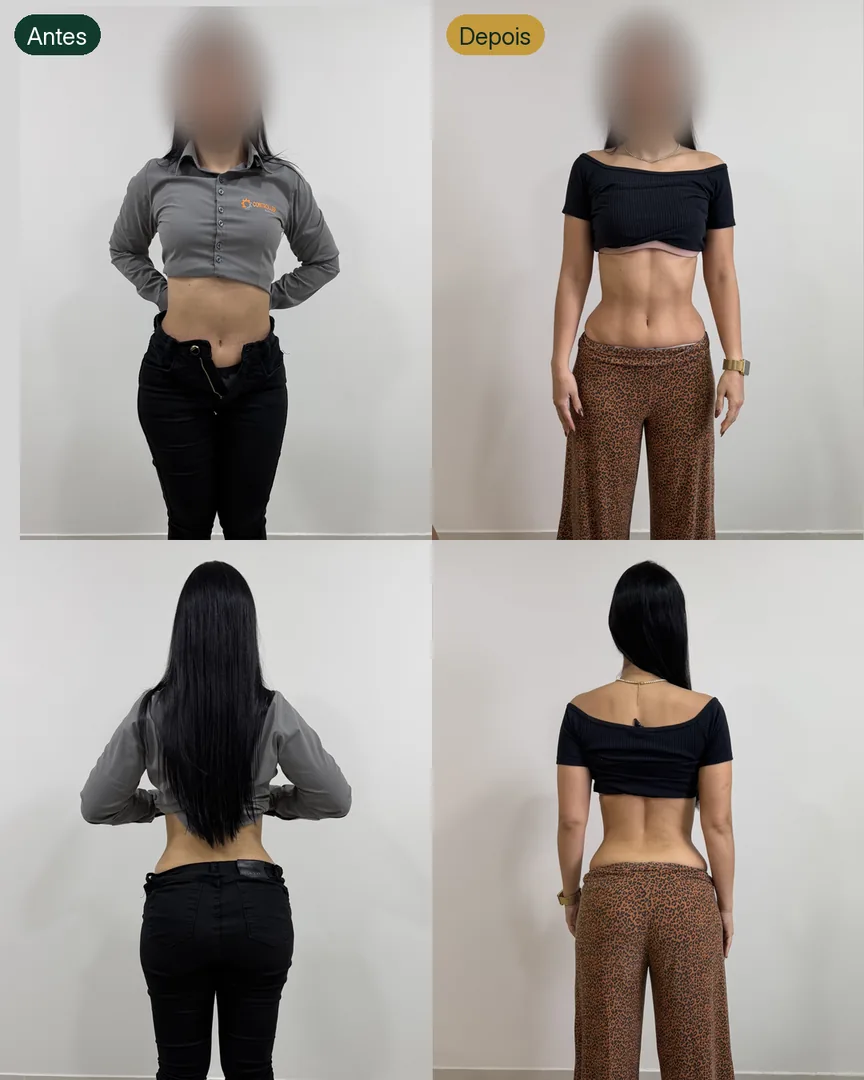 Antes e depois de paciente