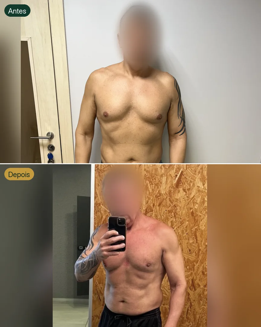 Antes e depois de paciente