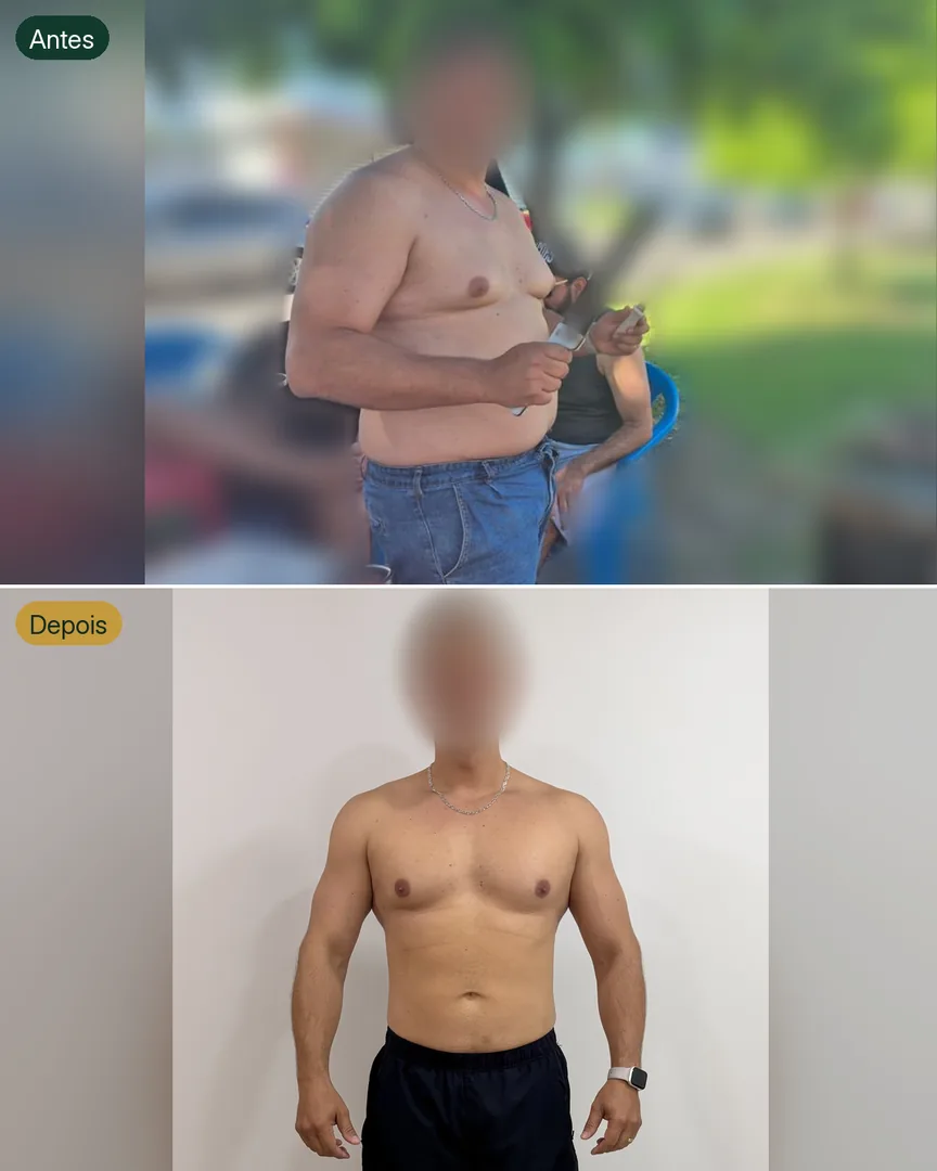 Antes e depois de paciente